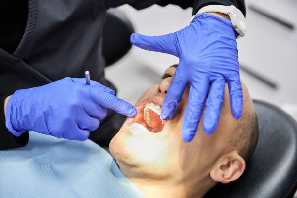 Best Emergency Broken Tooth Repair in Timonium, MD